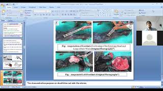 Download Lagu Fetotomy, Part-1 by Dr. Dushyant Yadav, Dept. of LFC (VGO), BVC, Patna Thumbnail
