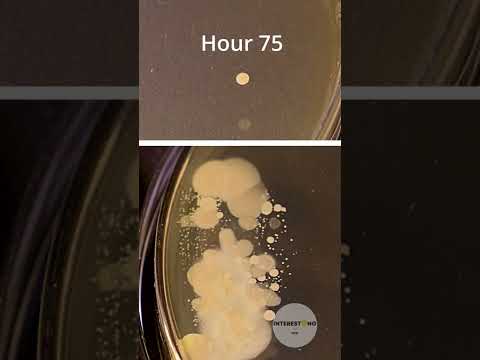 Washed vs dirty hands bacteria time lapse 🦠🧫 #bacteria #timelapse #shorts