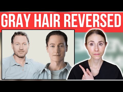Bryan Johnson's GRAY HAIR REVERSAL SUCCESS