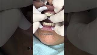 Mira los HUECOS QUE TIENE SU SONRISA 😥😭