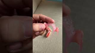 FLEXIBLE VS ORDINARY DENTURE (pustiso)
