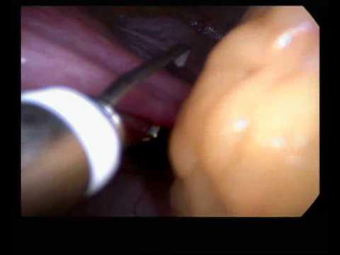 Rajani Hospital Video 7