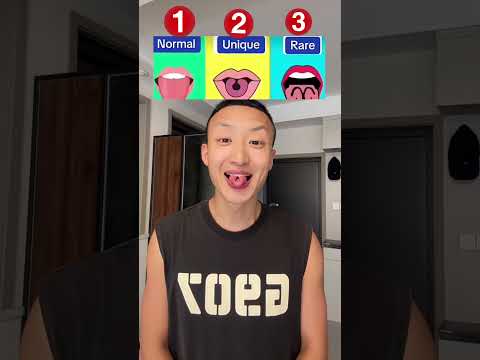 8162779455