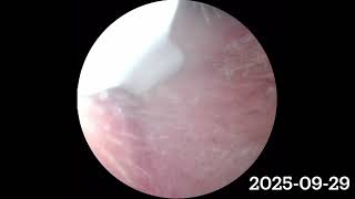 Relaxing Ear Cleaning ASMR | Deep Sleep, No Talking 2025-09-29 #asmr #deepsleep