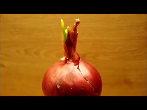 Ich wachte Finger Gelenkschmerzen MRI des Schultergelenks Verletzungen