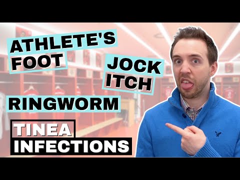 What Causes Ringworm Infection? Athlete’s Foot Cream. Treat Jock Itch (Tinea Cruris)