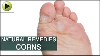 Skin Care - Corns - Natural Ayurvedic Home Remedies
