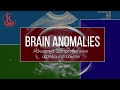 fetal neurosonography brain development and cns anomalies.