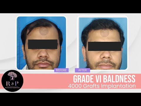 Clinic result video thumbnail