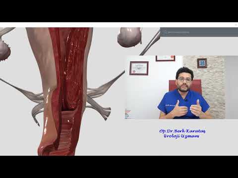 Penis Boyu ve Kalınlığı Ne olmalıdır? 10 cm Penis yeter mi? 20 cm Olsa Ne olur?