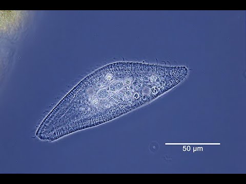 Wimpertierchen Litonotus  crystallinus (Zelle im kontrahierten Zustand)