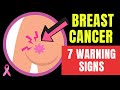 7 Warning Signs And Symptoms Of BREAST CANCER Doctor O Donovan Explains