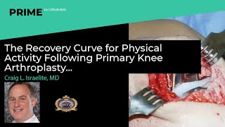 Recovery Curve for Physical Activity Following Primary Knee Arthroplasty - Craig L. Israelite, MD
