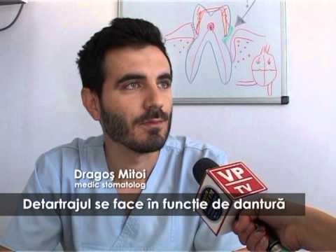Detartrajul se face în funcţie de dantură