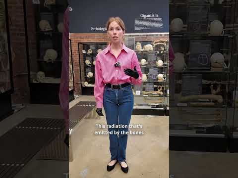 What are bone scans? #bones #science #biology #facts