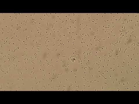 Stenotrophomonas maltophilia in wet mount of Tryptone soy broth after 3 days of incubation