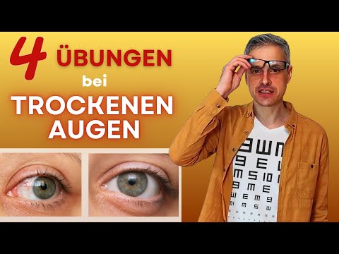 TROCKENE AUGEN: Ursachen, Tipps und 5 Minuten Übungen
