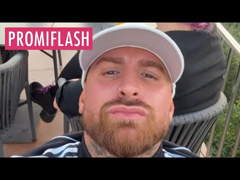 Er vermisst seine Jawline: Gigi Birofio lässt nachhelfen