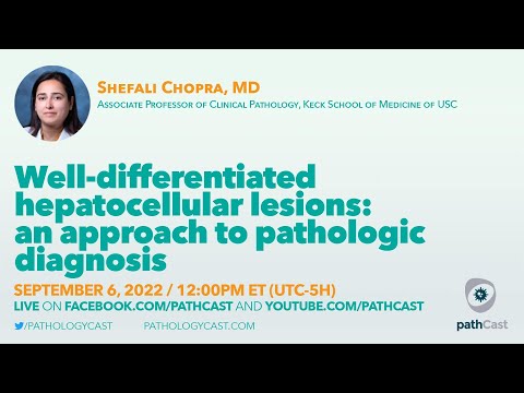 #LIVERPATH Well-differentiated hepatocellular lesions: an approach to pathologic diagnosis