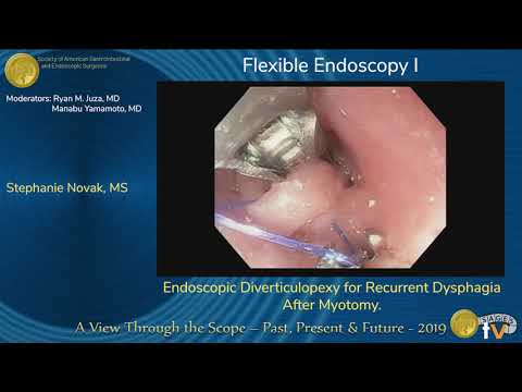 Endoskopowa diwertikulopeksja z powodu nawracającej dysfagii po miotomii