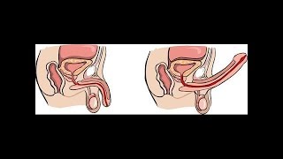 Mental Impotence? This Video May Finally Cure Your Sexual Performance Anxiety