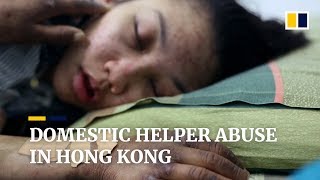 Abuse of foreign domestic helpers in Hong Kong prompts calls for better protection