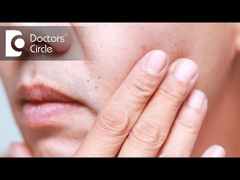 What causes red dots on face and its management? - Dr. Nischal K