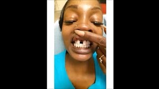 Kevin McCall Knocks TOOTH Out Victim SPEAKS (Video from Hospital) Domestic Violence He BEAT Woman Up