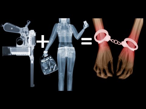 Как справиться с болью в спине и ногах Виды вывиха тазобедренного сустава