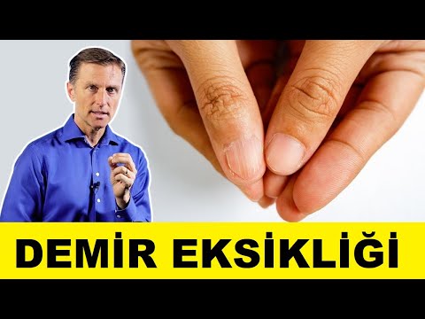Demir Eksikliği Belirtileri Ve Anemi Nedenleri - Dr. Berg Türkçe