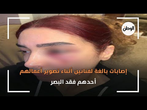 إصابات بالغة لفنانين أثناء تصوير أعمالهم.. أحدهم فقد البصر