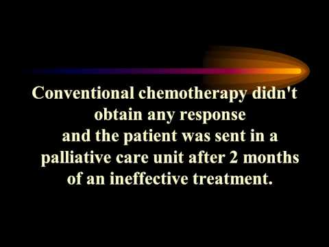 Treatment of advanced pelvic osteosarcoma with chemotherapy directly inside de tumor. Case report.