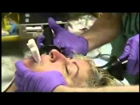 Shock Electroconvulsive Therapy