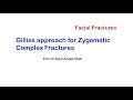 Gillies Temporal approach| Zygomatic Complex Fractures| Oral Maxillofacial Surgery | Syed Amjad Shah