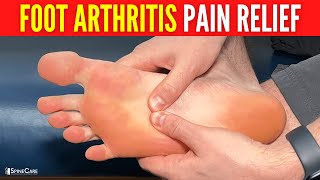 How to INSTANTLY Relieve Foot Arthritis Pain