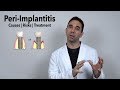 Peri-Implantitis (Infected Dental Implant Treatment Options)