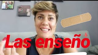 Reduccion de pecho..¿duele¿como fui a la seguridad social CICATRICES