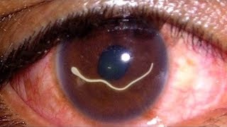 10 Worst Things That Can Happen to Your Eyes