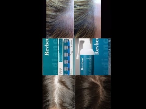 وداعا لتساقط الشعر مع اسبراي وامبولات ريفبين لعلاج تساقط وتطويل وتكثيف الشعر Revben lotion