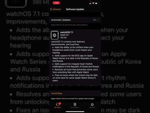 Quickie Ep 7: WatchOS 7.1 out now
