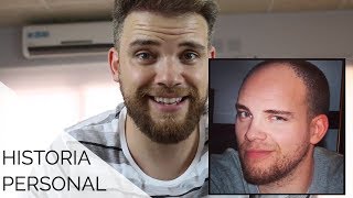 UNA HISTORIA PERSONAL: ¿Tengo que tomar pastillas para el pelo para toda la vida