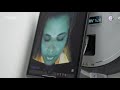 Observ 520 Skin Analysis MySkin Clinics