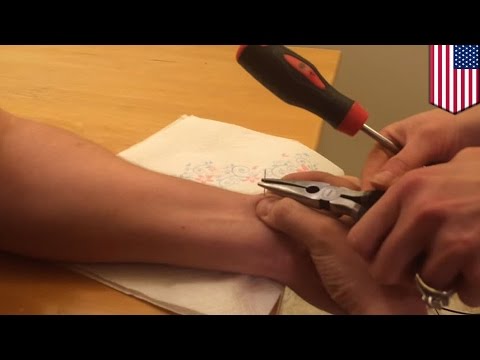 Ile jest wzrost członka chirurgicznie Ile jest operacja powiększenia penisa