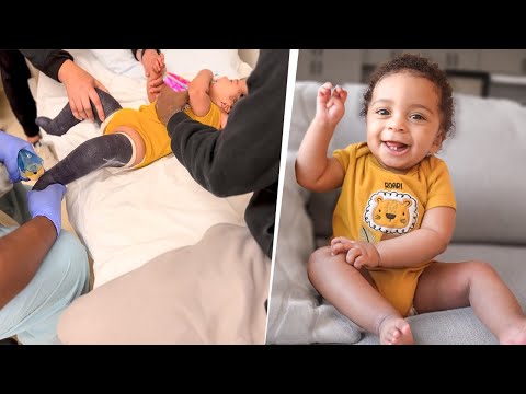 Kai Got His Casts Removed…