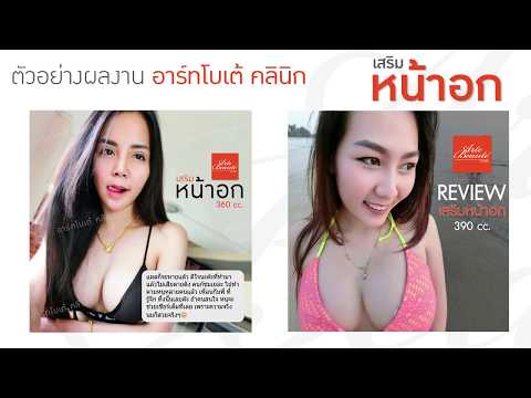 ซีสต์หน้าอกเล็ก หน้าอกเล็กและจิตวิญญาณ