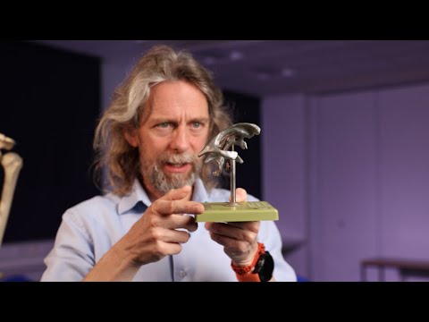 Lateral ventricles of the brain anatomy