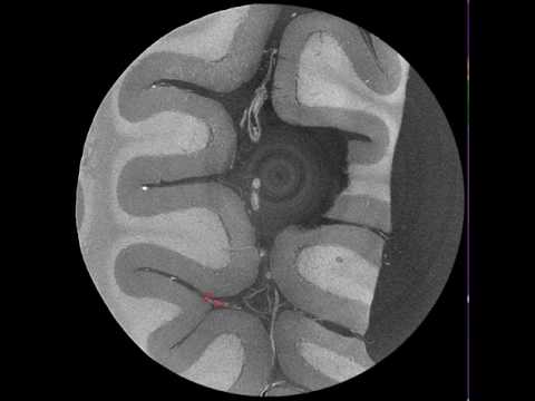 Manual landmark selection cerebellum