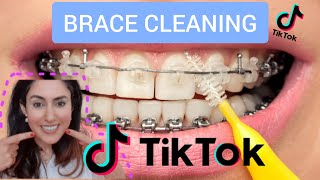 Orthodontist Reacts To Braces Cleaning Tik Tok