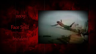 The 2009 Face Split Incident