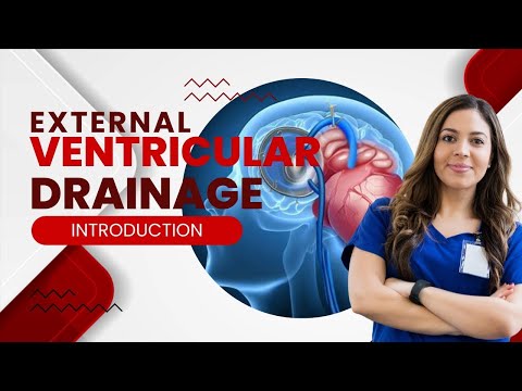 Mastering External Ventricular Drainage: Your Ultimate Guide!